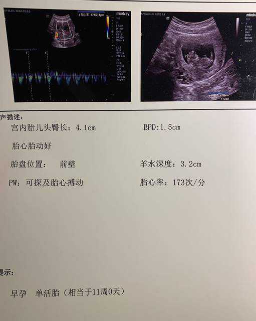 广州有没有代孕中心，广州市妇女儿童疗中心挂号就诊