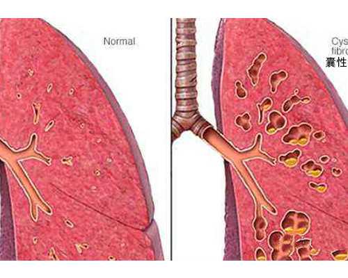 零首付包成功,子宫摘除手术过程需要多久时间？
						