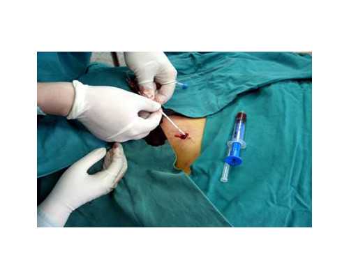 (佛山代生的条件是什么成功案例)佛山妇幼做代生的条件是什么有成功案例吗