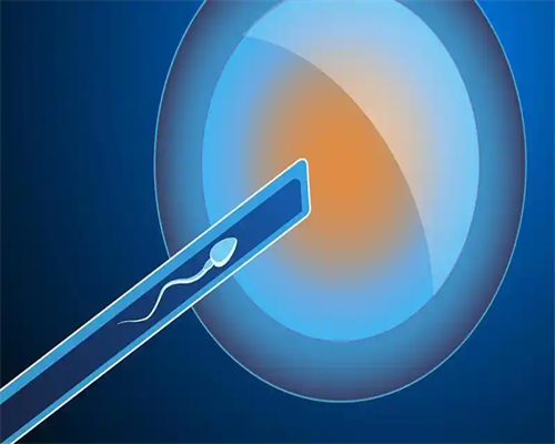 包生男孩包成功,女性备孕是否比较好不要熬夜？熬夜是否会导致不孕不育？