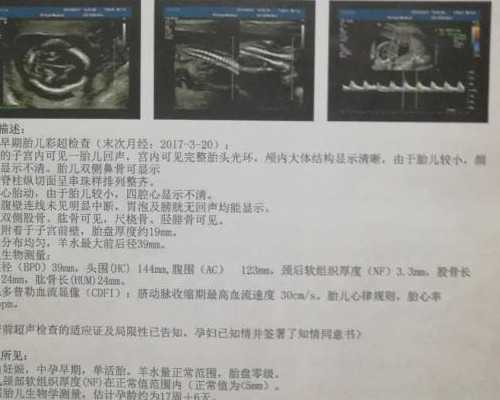 哪里做试管包男孩最好,沙河不孕不育医院排名，沙河看不育不孕的生殖医院哪