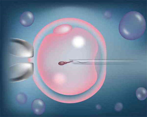 江苏代生子前促排卵针怎么打肚皮，江苏代生子前促排针要打几天